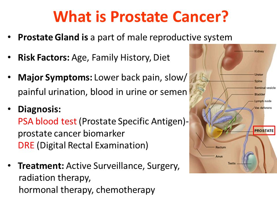 How do you get tested for prostate cancer